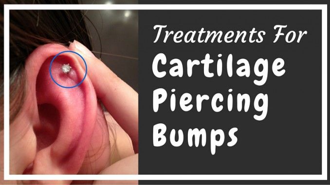 ear cartilage piercing care instructions